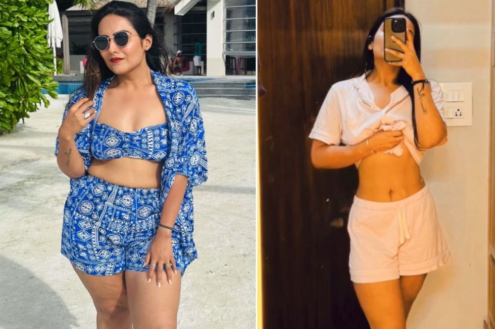 Richa before and after