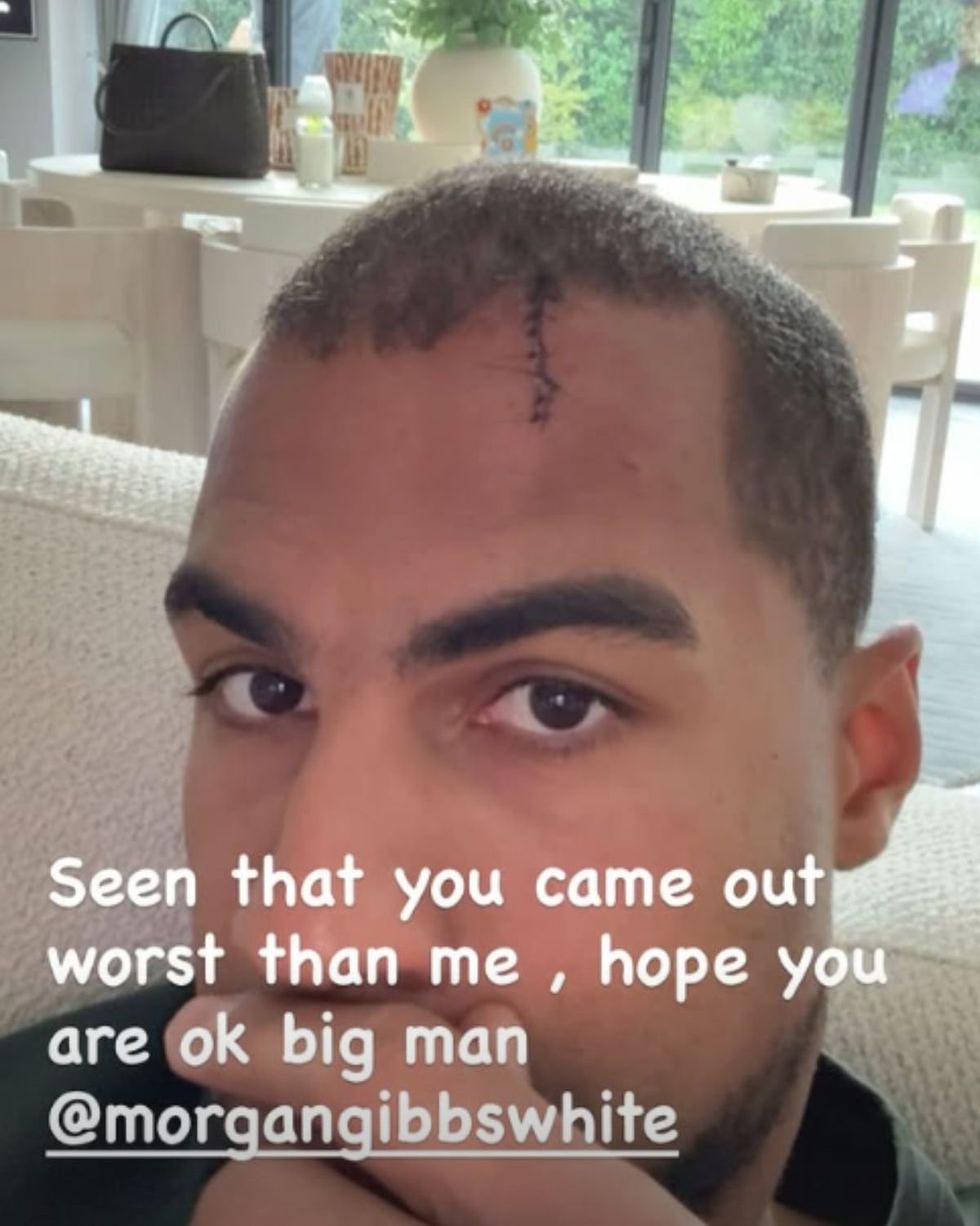 Robert Sanchez also showed off his own scar after being forced out of Chelsea's match with Nottingham Forest