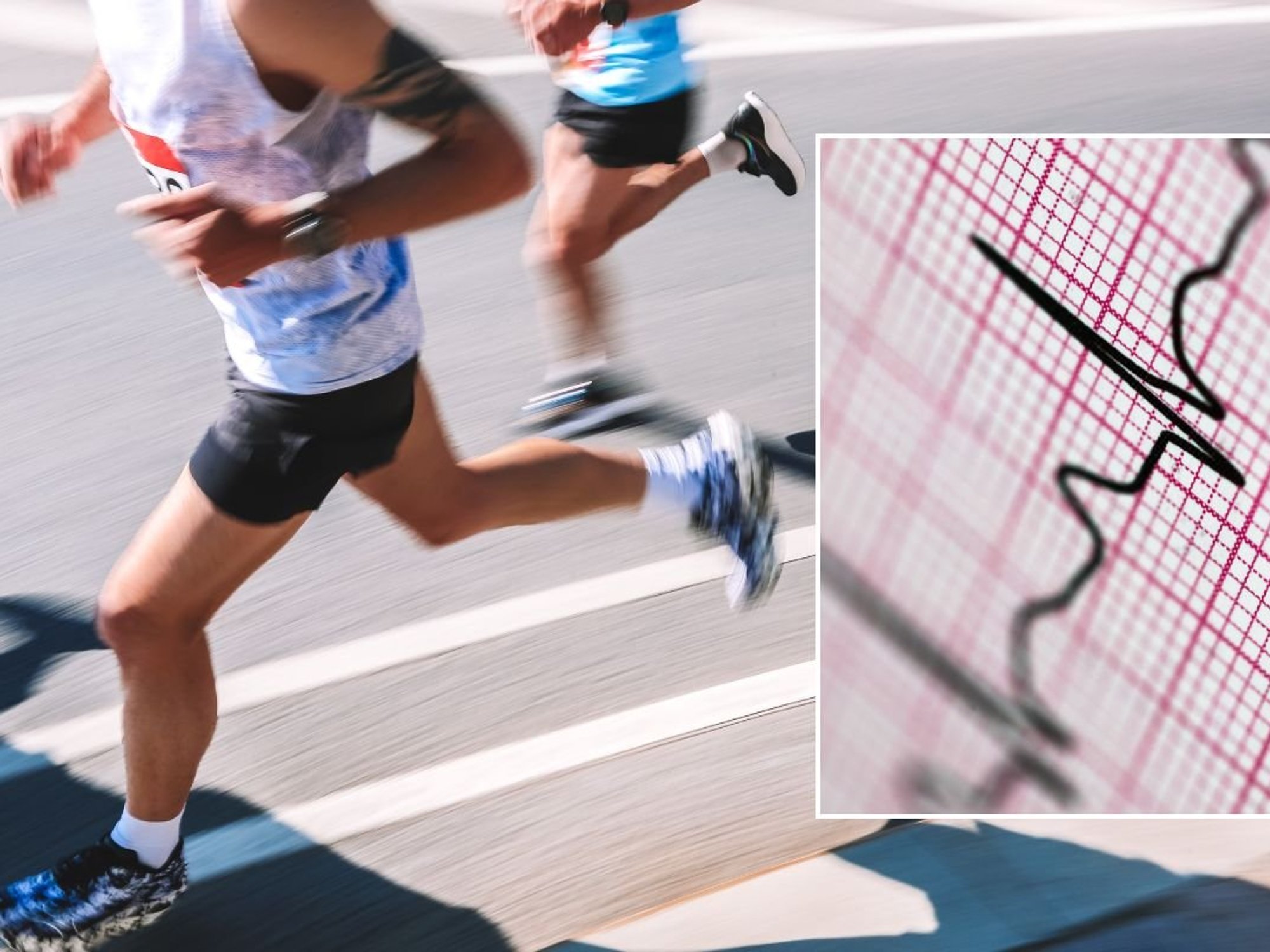 RUNNER AND ECG SCRIPT