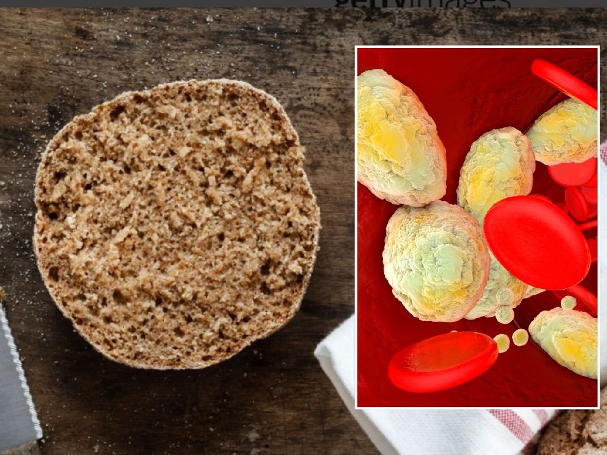 rye bread and blood lipids