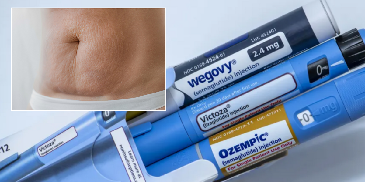 Ozempic side effect leaves weight-loss drug users looking like 'melted candles'... and it affects young people too - GB News