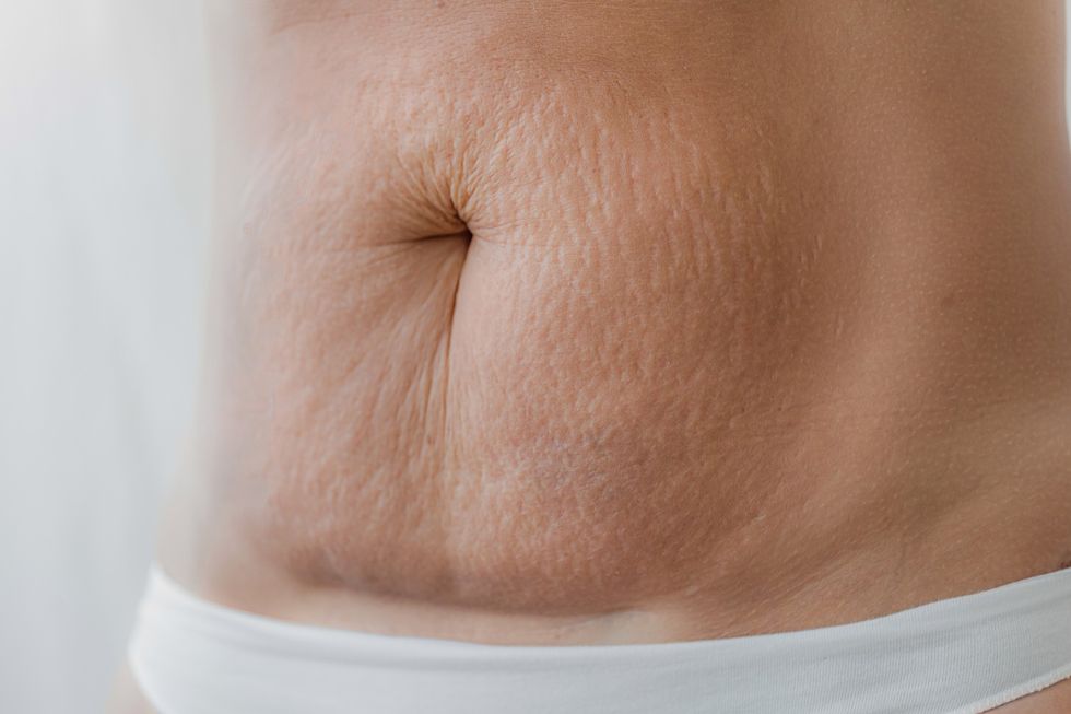 Sagging skin