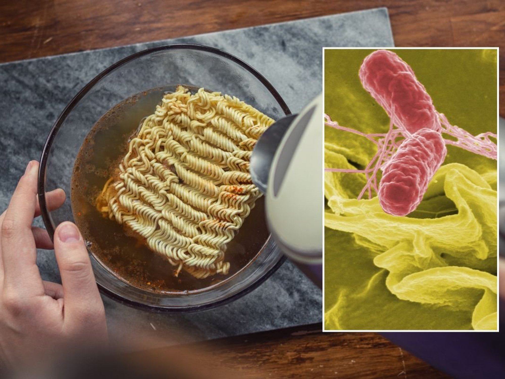 SALMONELLA bacterium