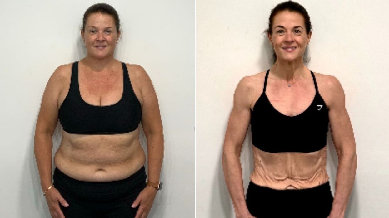 Samantha before and After