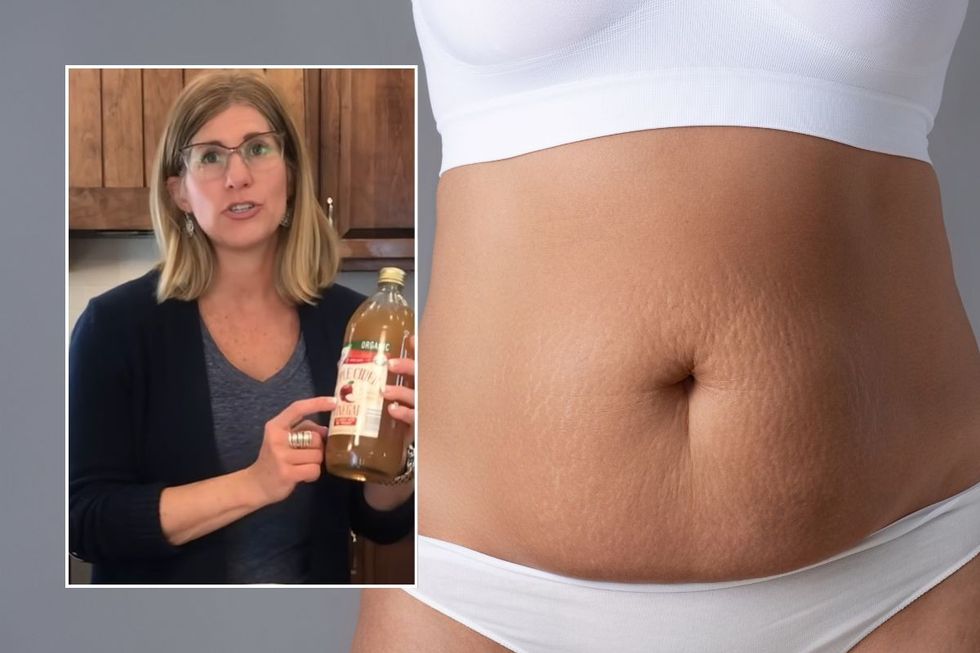 Sandy headshot and belly fat stock image