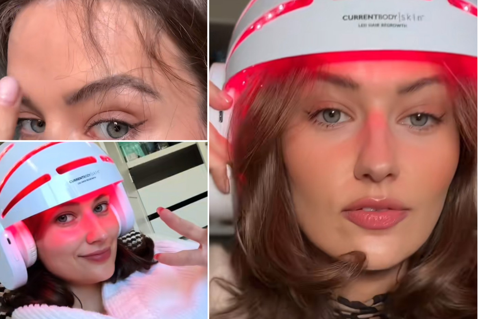 Sarah Palmyra wearing a red light helmet in her TikTok, showing new hair regrowth