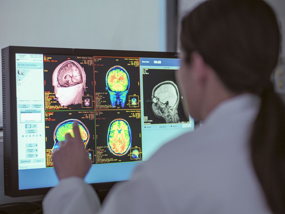 Scientist studies brain activity