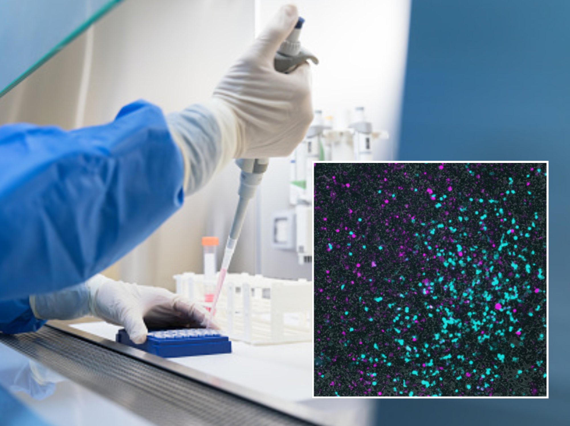 Scientists doing laboratory work; diagram showing viruses and bacteria by the researchers at Columbia
