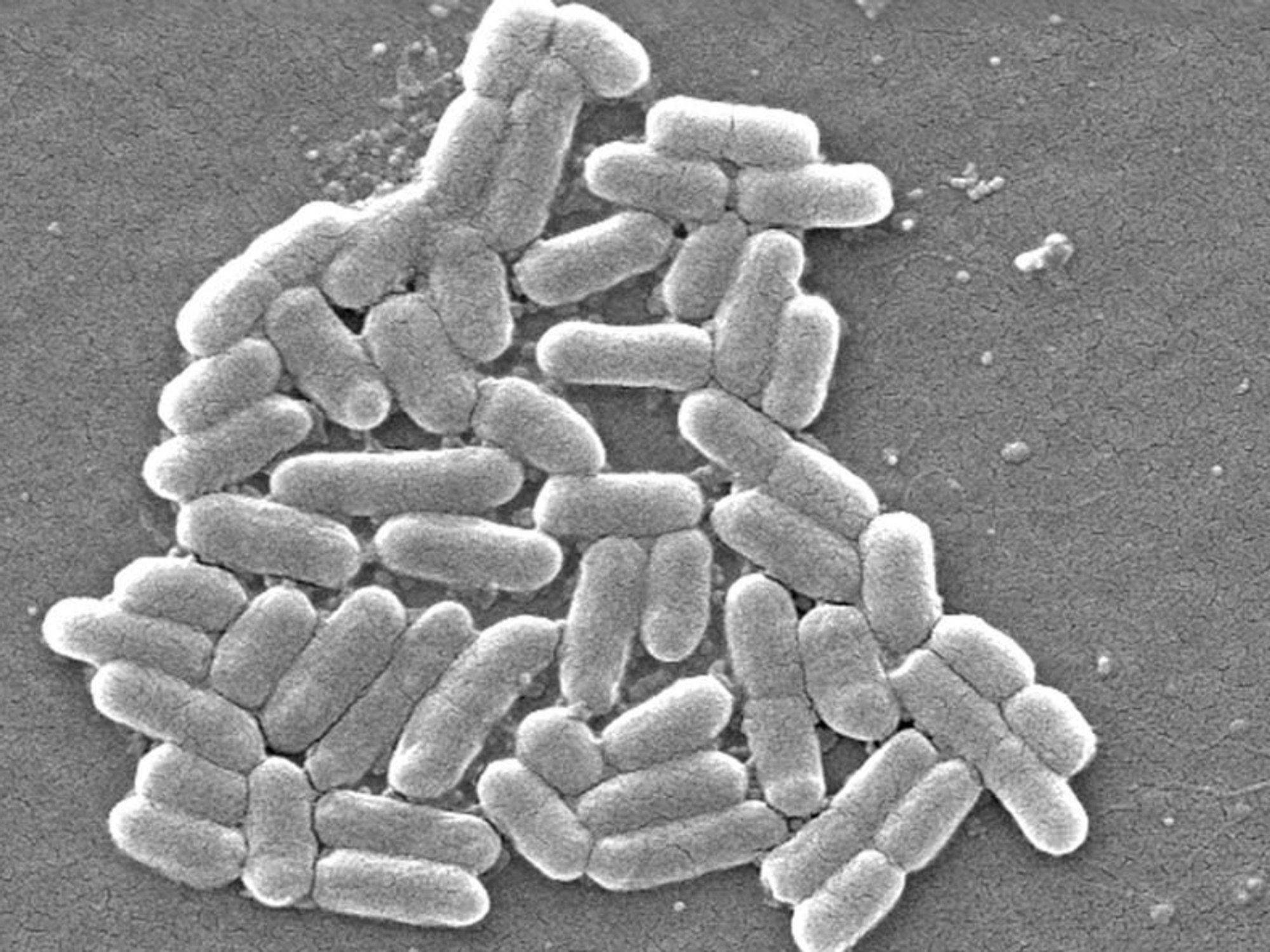 Scientists observed the E Coli micro-organism