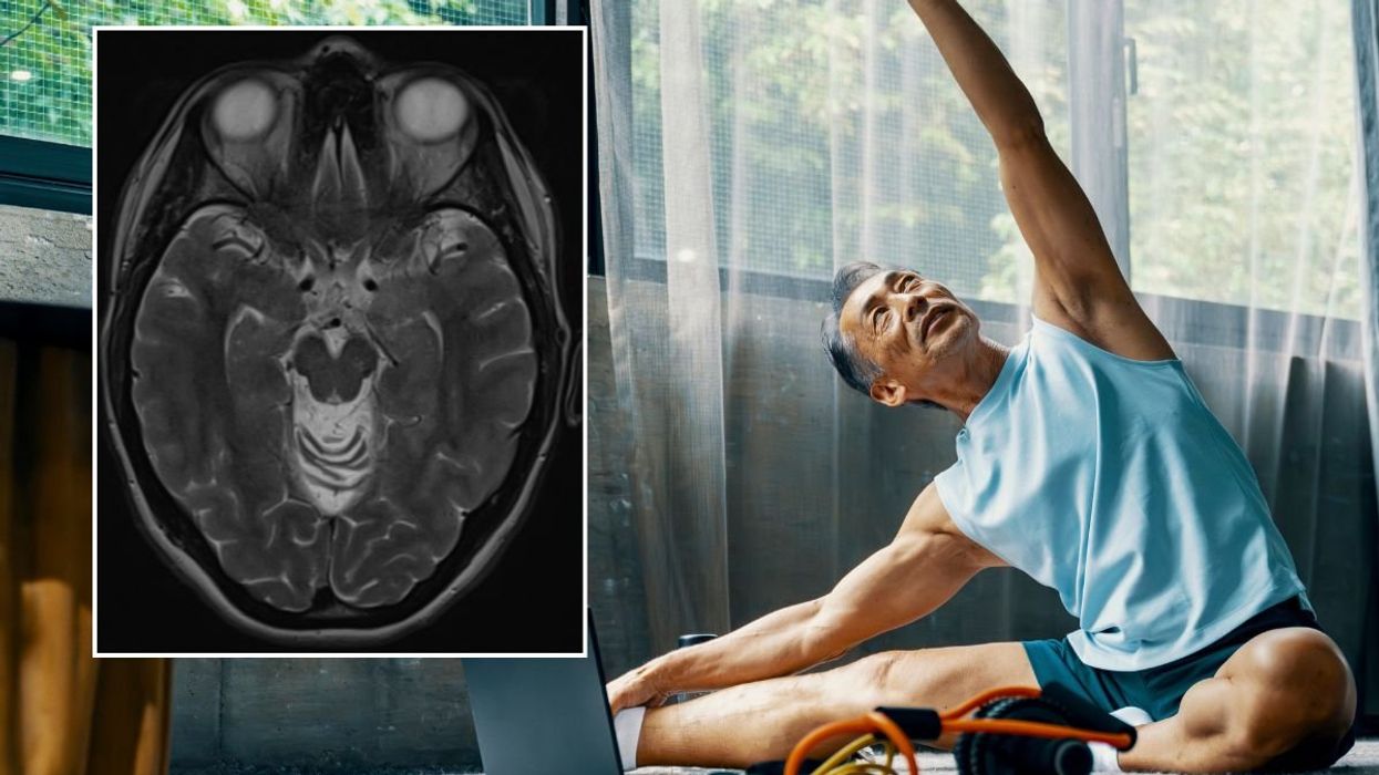 SENIOR MALE STRETCHING / BRAIN SCAN