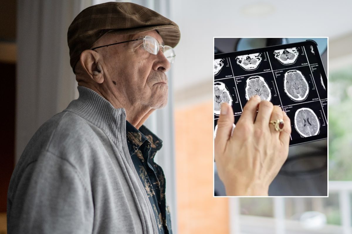 SENIOR MAN AND BRAIN SCAN