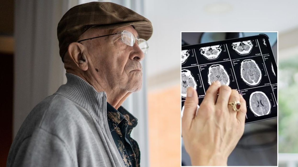 SENIOR MAN AND BRAIN SCAN