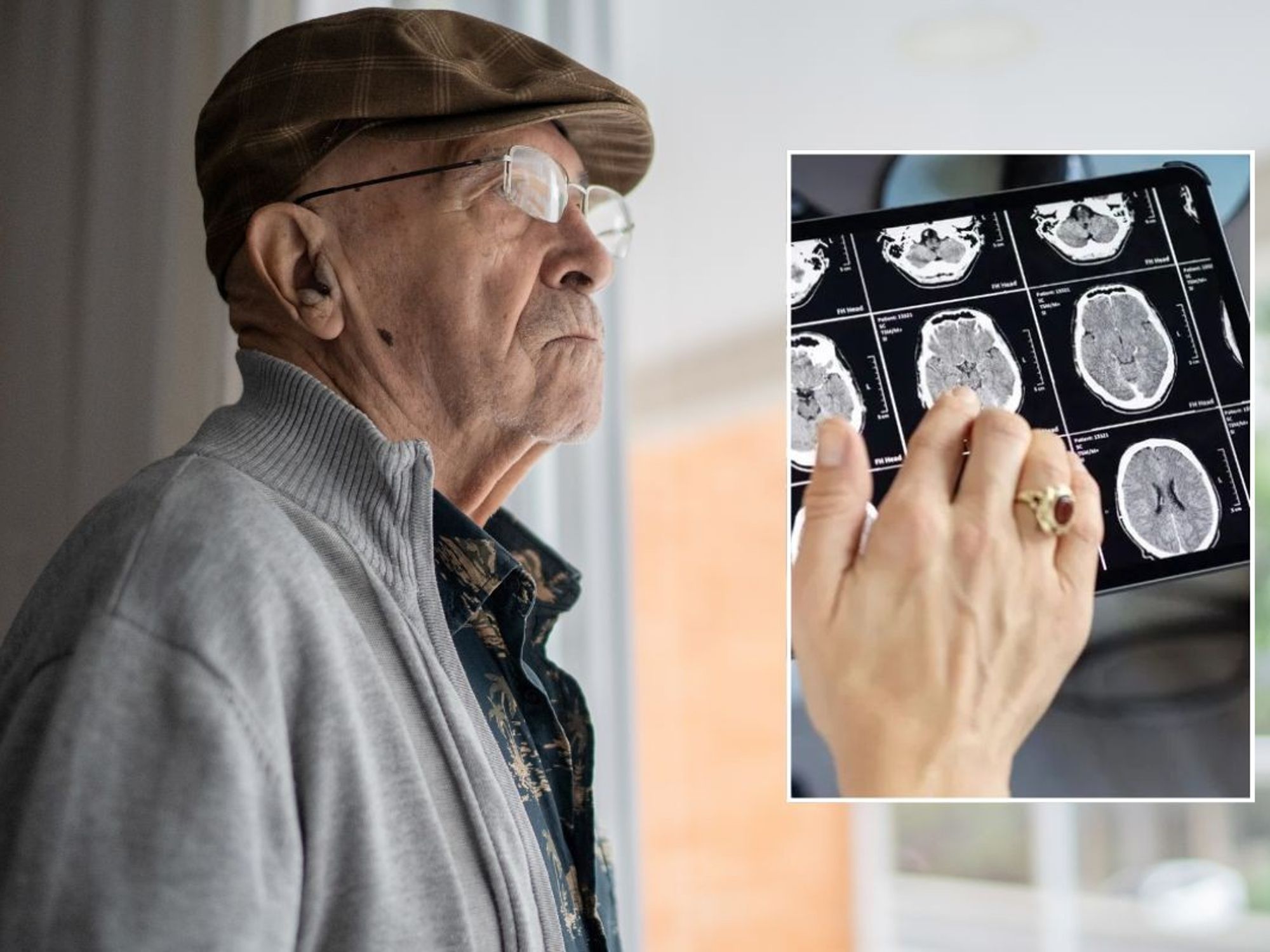 SENIOR MAN AND BRAIN SCAN