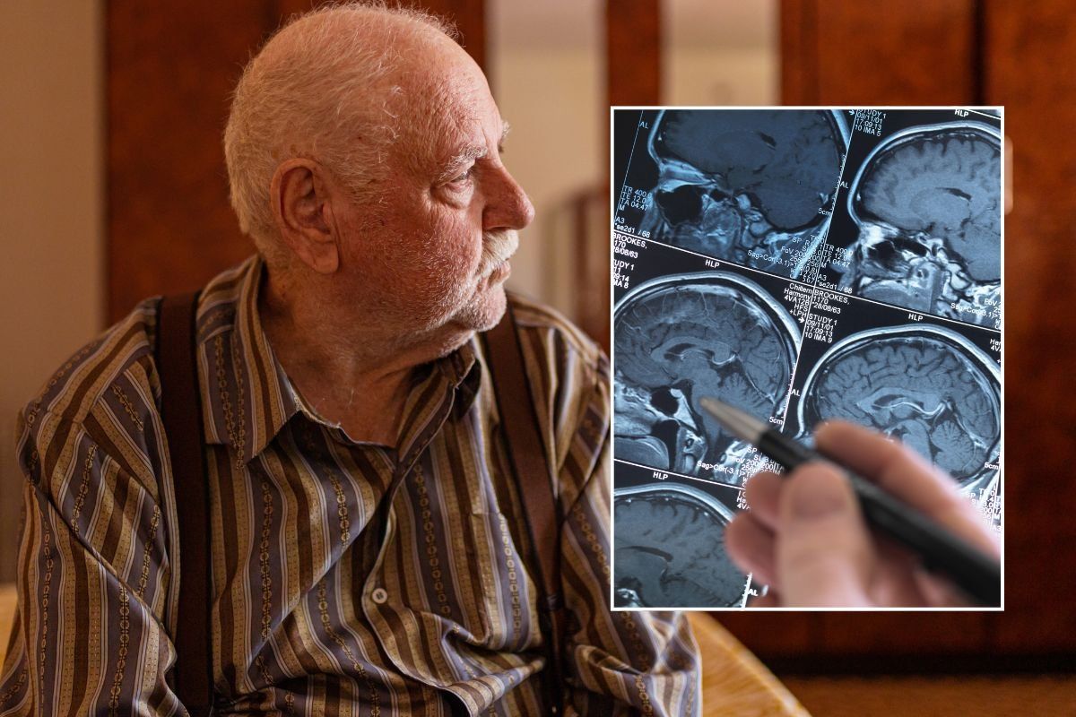 SENIOR MAN AND BRAIN SCAN