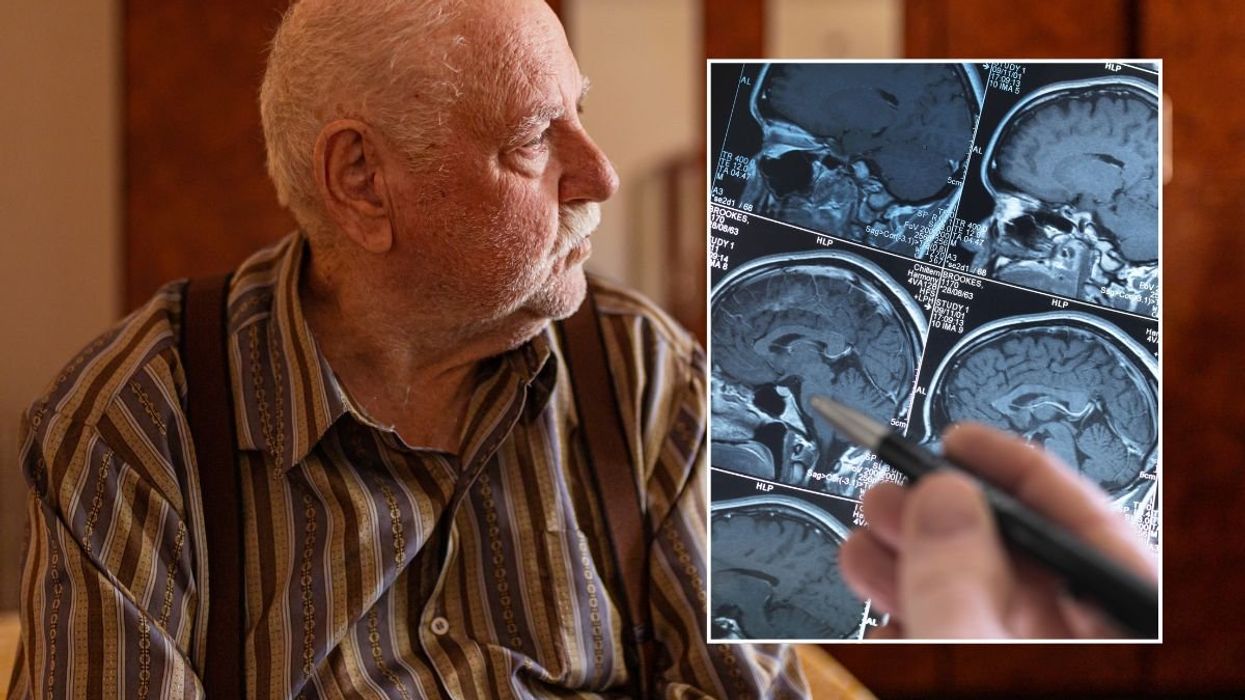 SENIOR MAN AND BRAIN SCAN