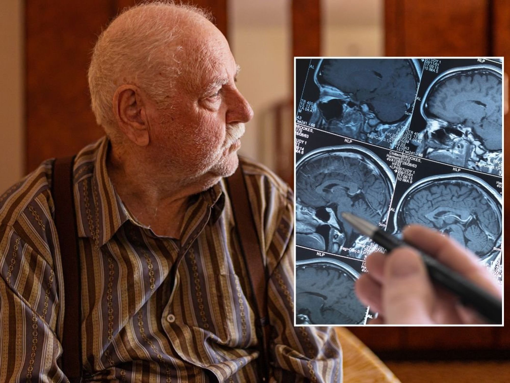 SENIOR MAN AND BRAIN SCAN