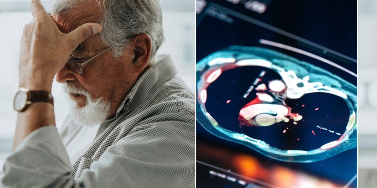 NextImg:Scientists reveal UK area hit hardest by brain disease that causes organ 'to decay over time'