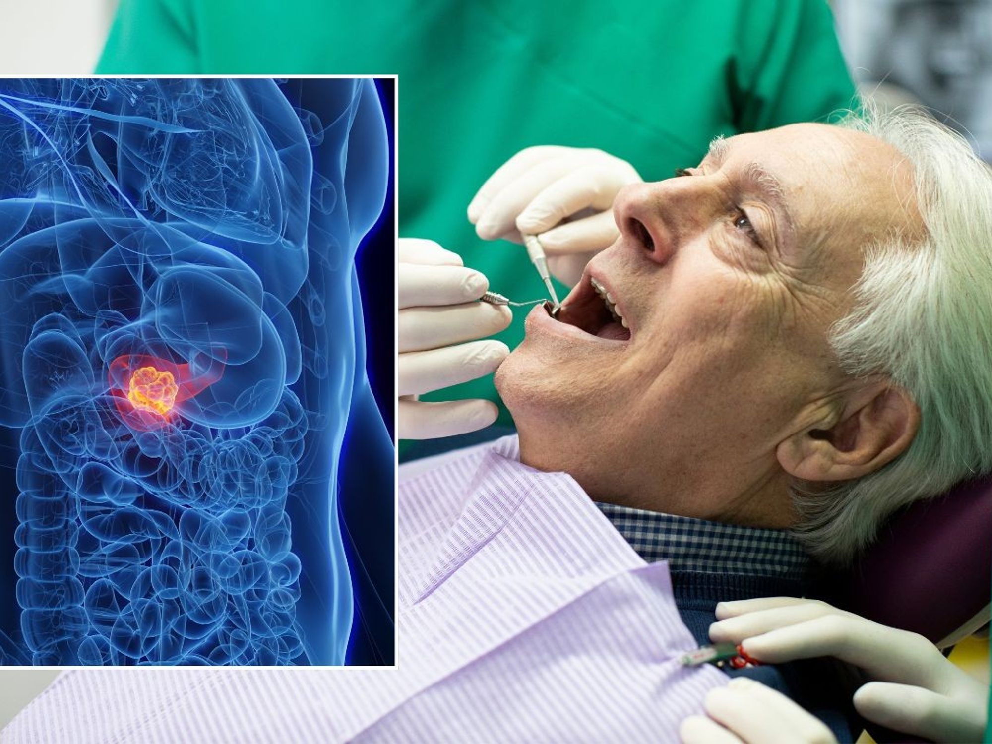 SENIOR MAN HAVING TEETH CHECKED