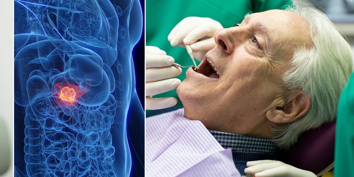 NextImg:Two dental steps you should never skip or risk tripling your chance of the 'deadliest common cancer'