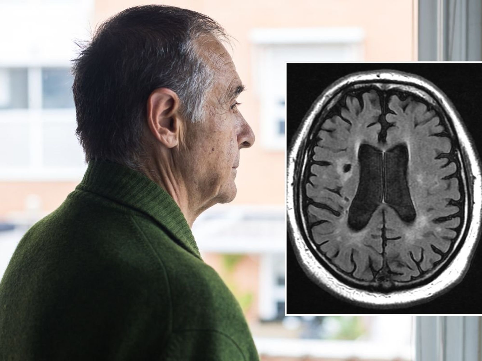 Senior man looking out window