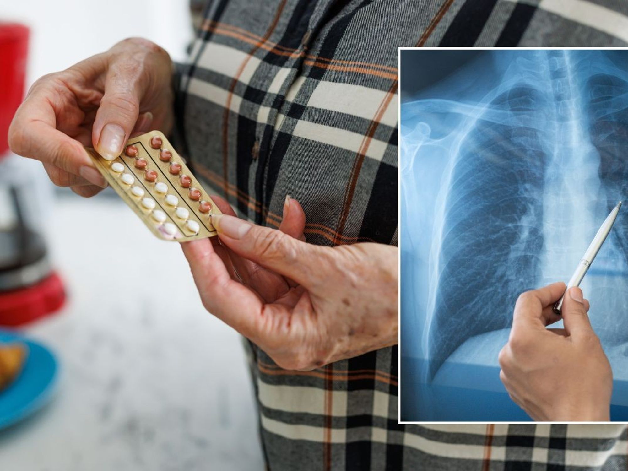 SENIOR PERSON HOLDING PILLS AND LUNG SCAN