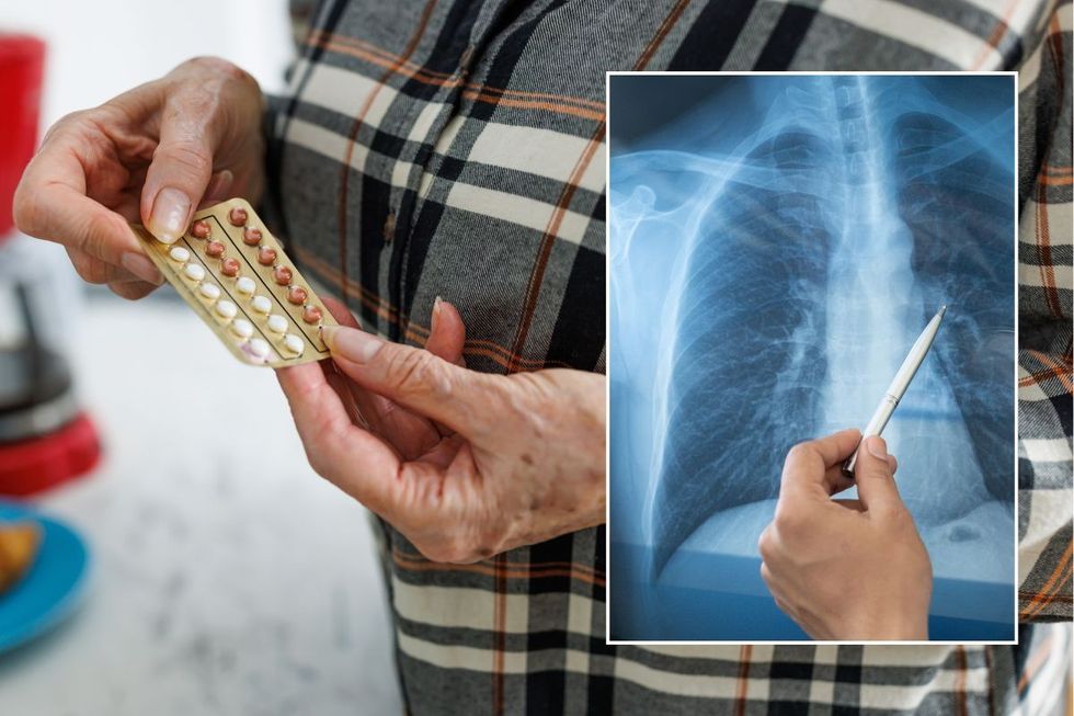 SENIOR PERSON HOLDING PILLS AND LUNG SCAN