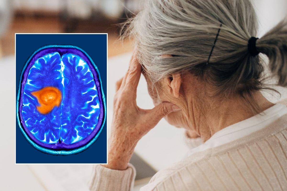 SENIOR WOMAN AND BRAIN SCAN