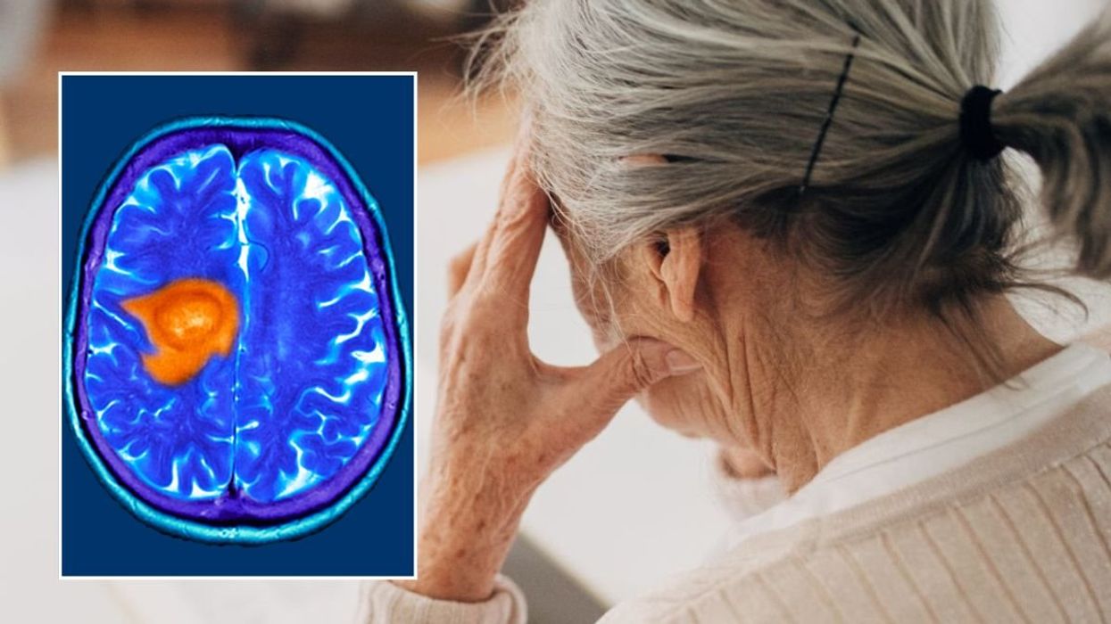 SENIOR WOMAN AND BRAIN SCAN