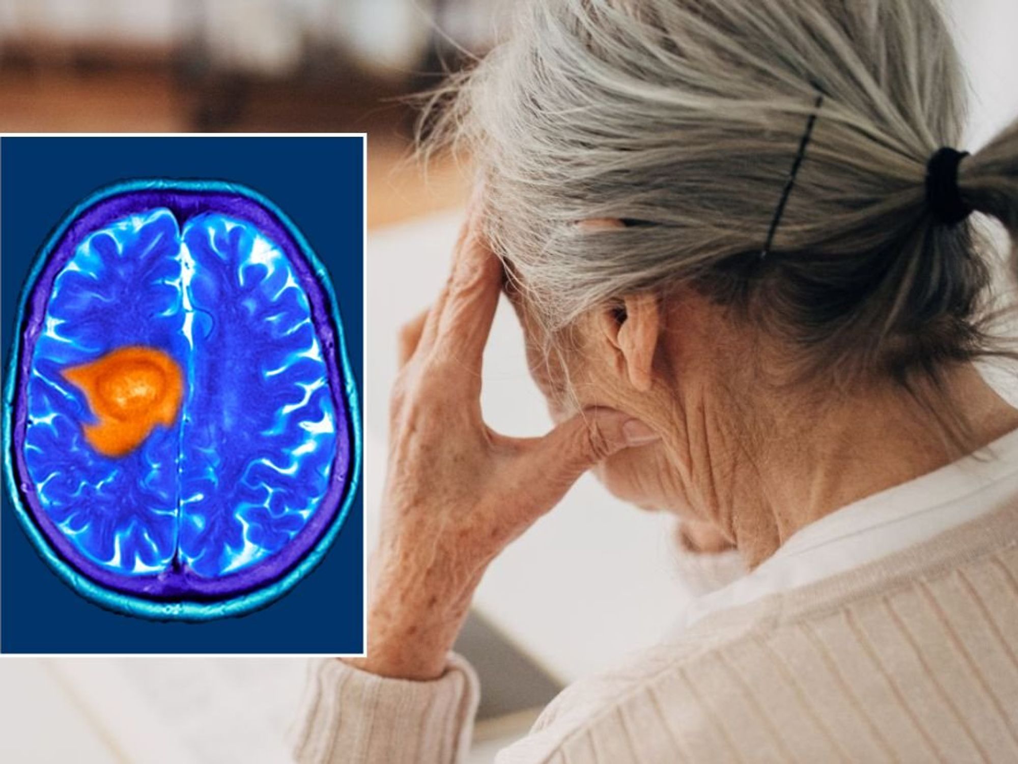 SENIOR WOMAN AND BRAIN SCAN