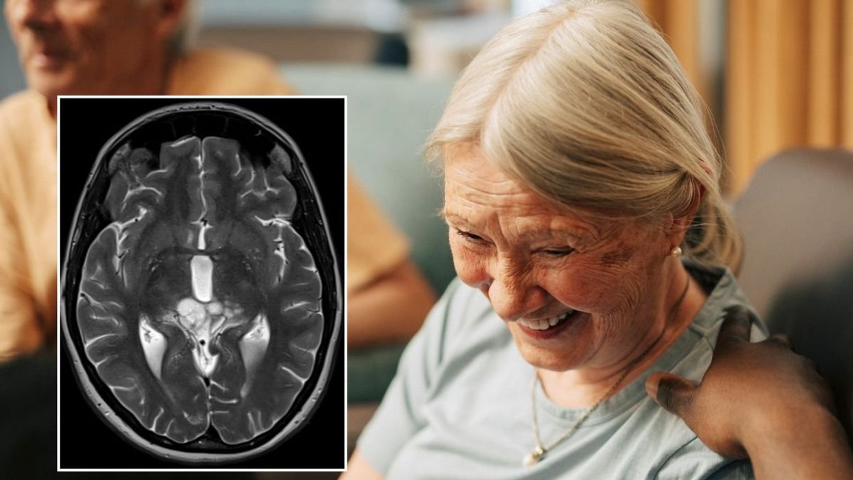 SENIOR WOMAN - BRAIN SCAN STOCKS