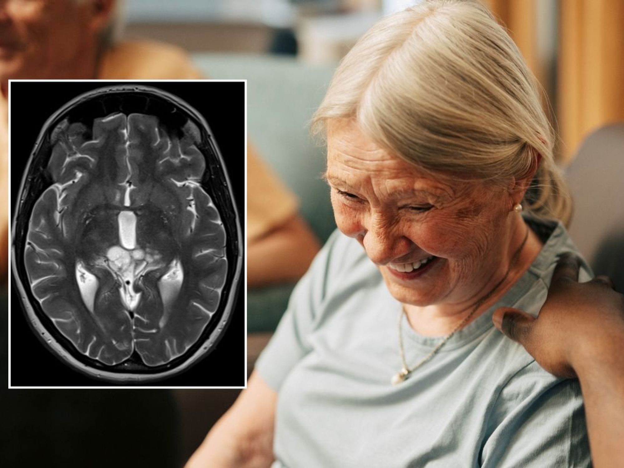 SENIOR WOMAN - BRAIN SCAN STOCKS