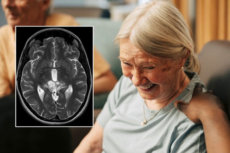 SENIOR WOMAN - BRAIN SCAN STOCKS