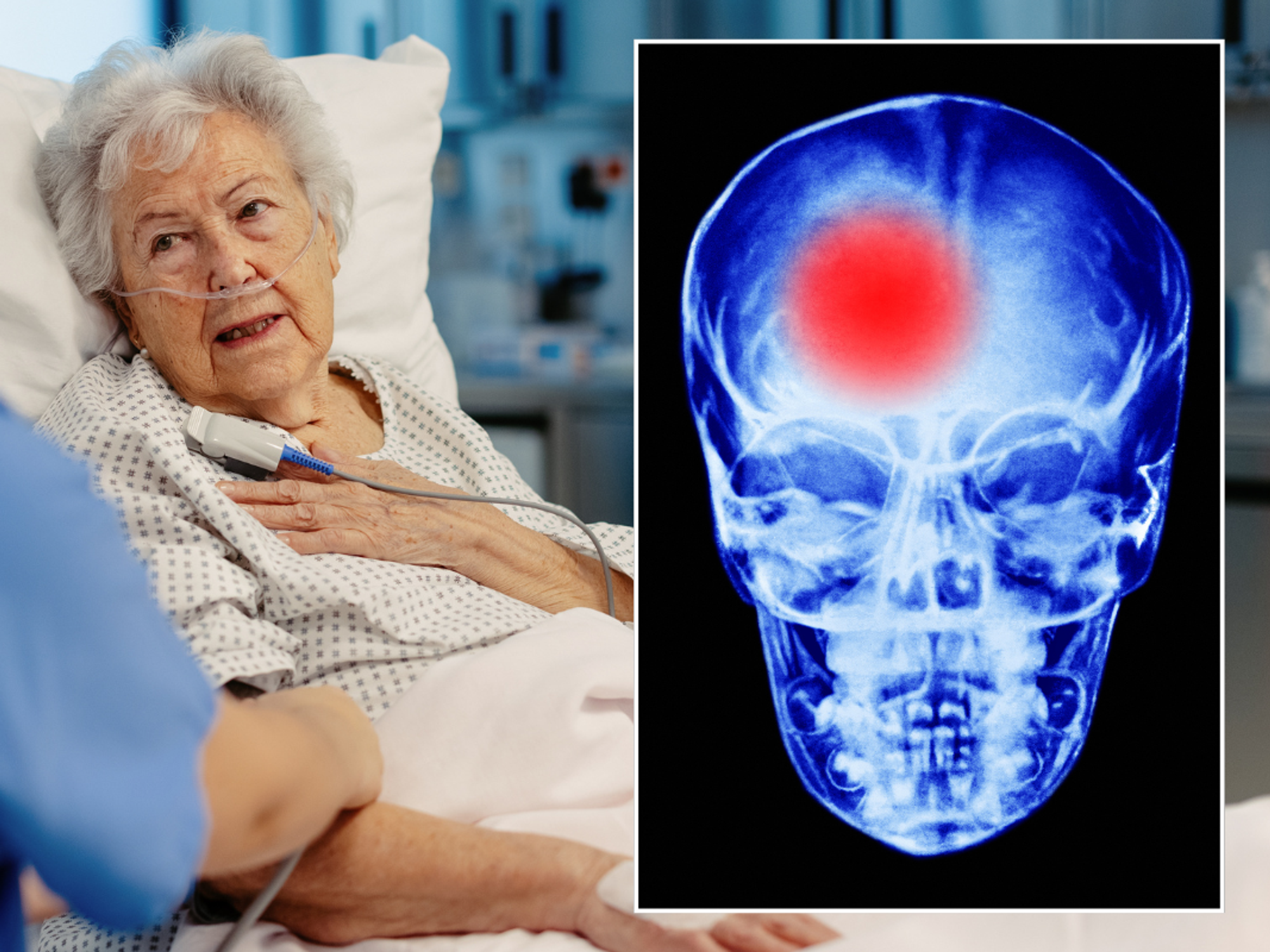Senior woman in a hospital bed being tended to by a doctor; brain scan