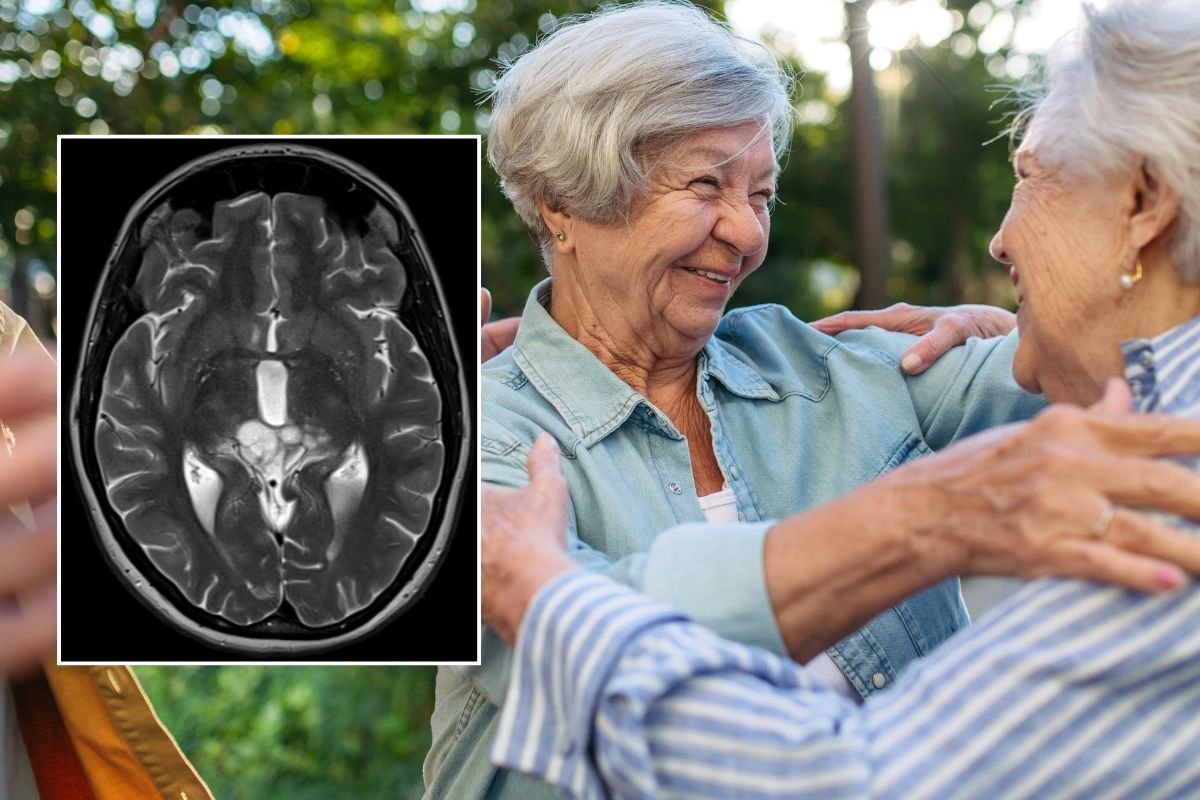 SENIOR WOMEN AND BRAIN SCAN