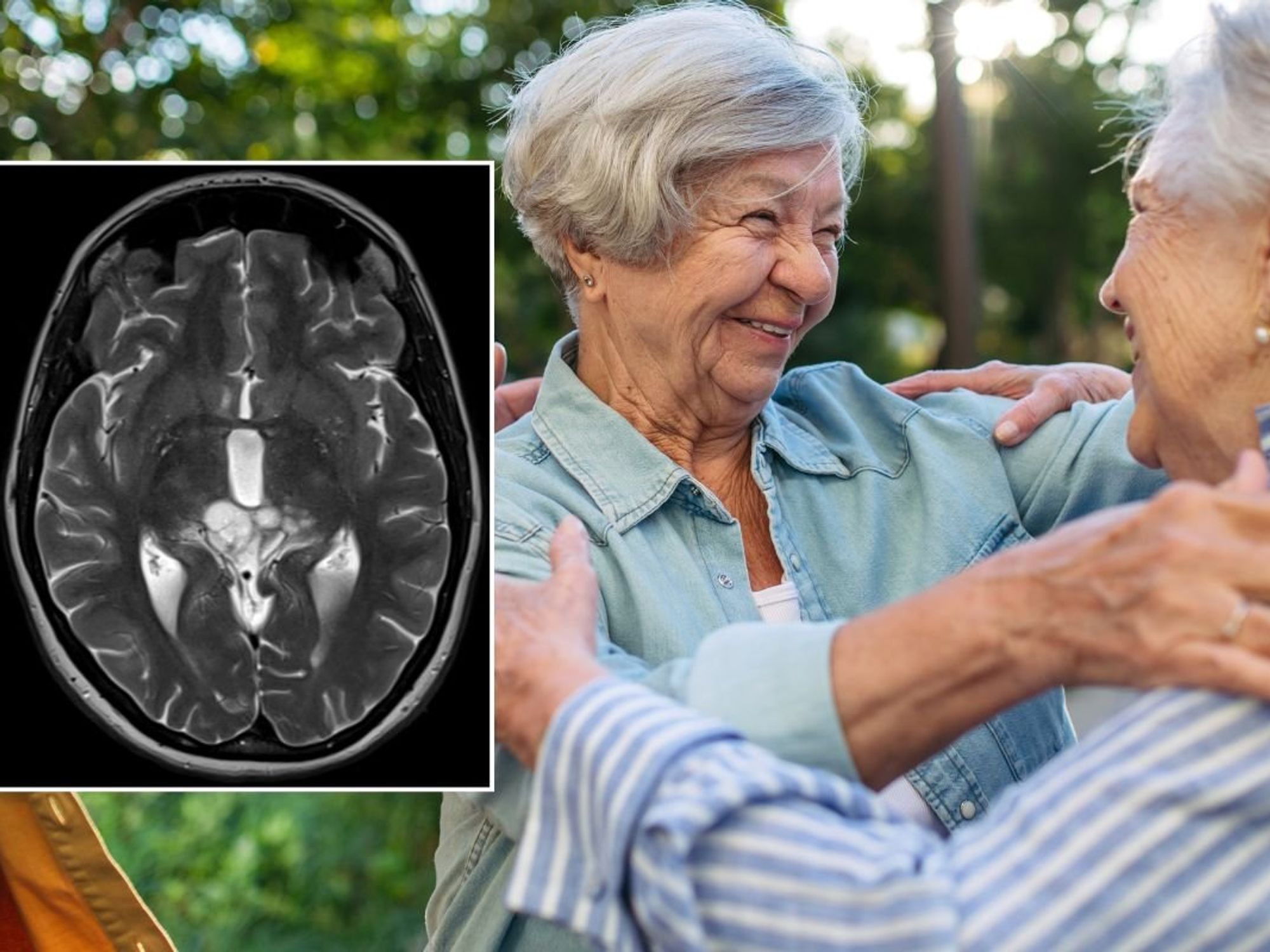 SENIOR WOMEN AND BRAIN SCAN