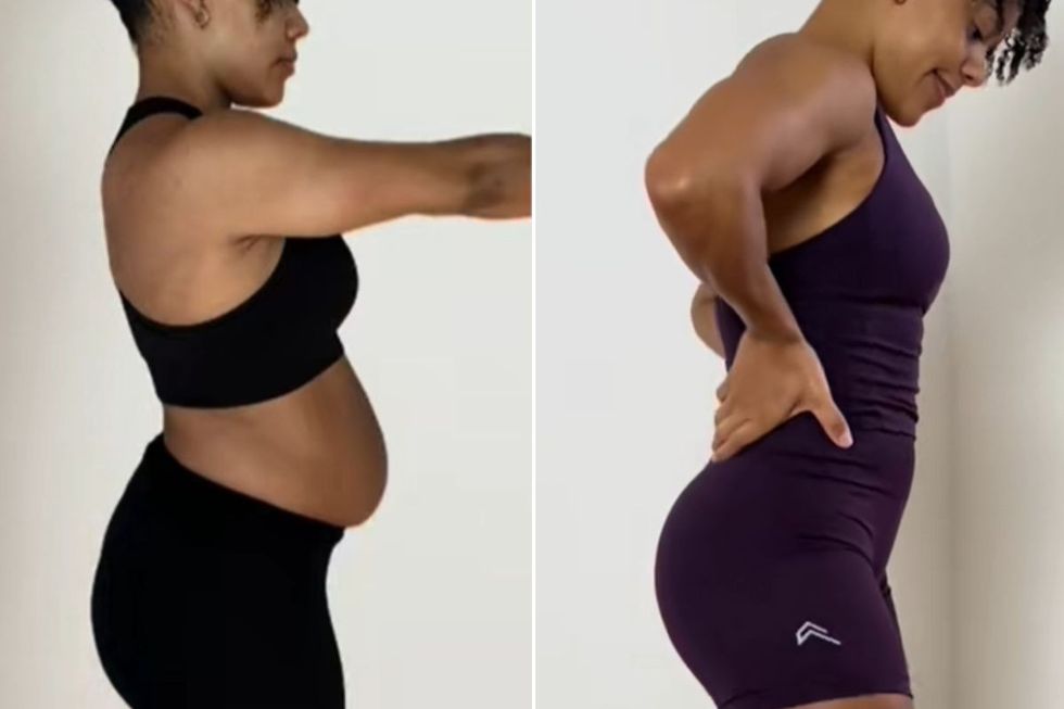 SERAFINABNU before and after