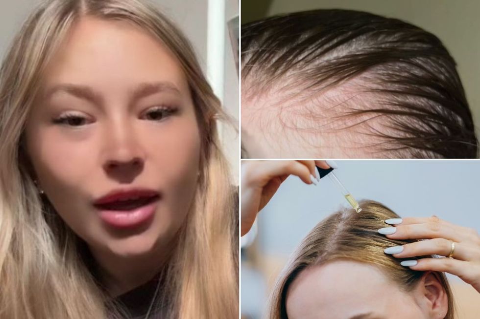 Shan before and after hair transformation / Woman applying hair oil
