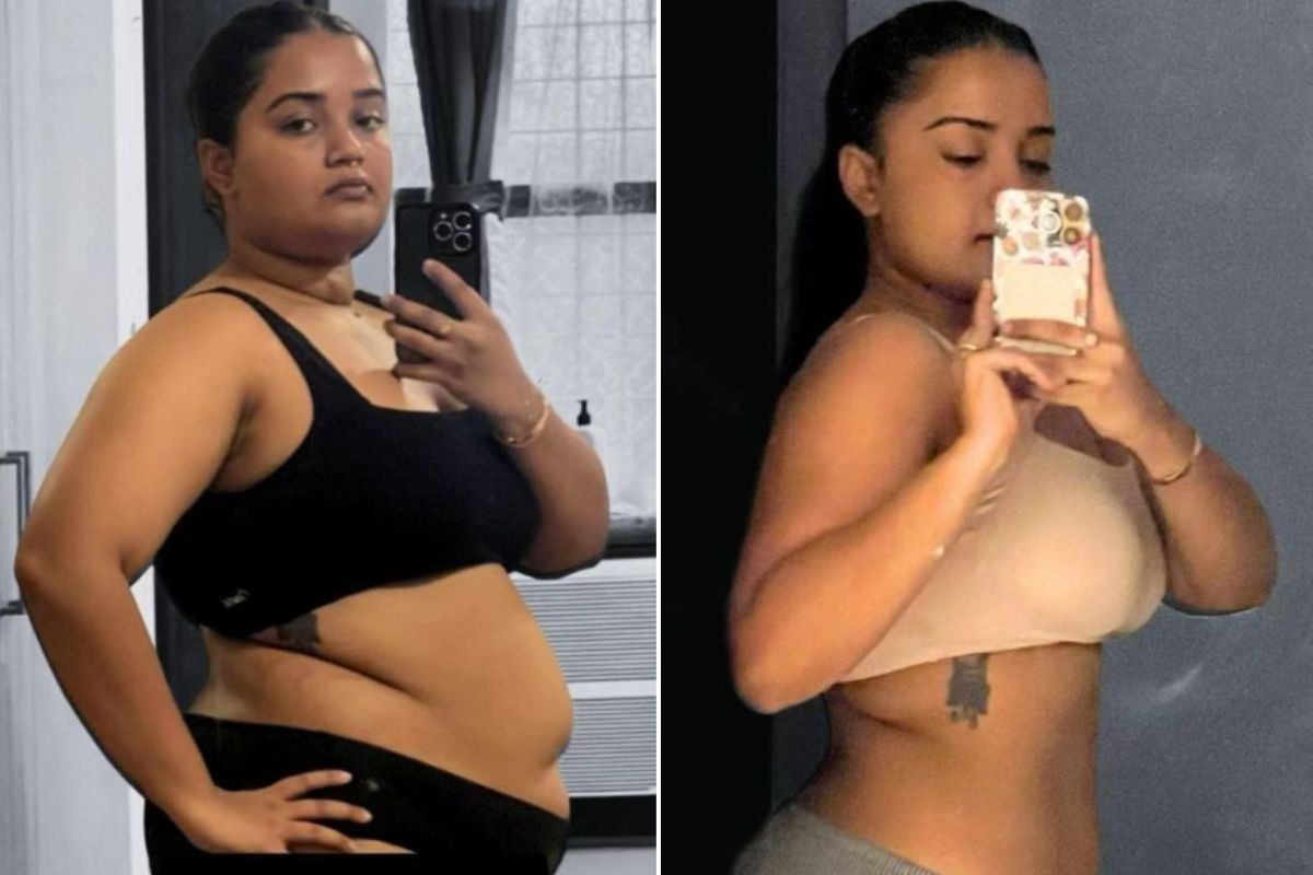 SHARON BEFORE AND AFTER