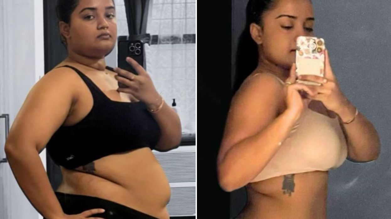 SHARON BEFORE AND AFTER