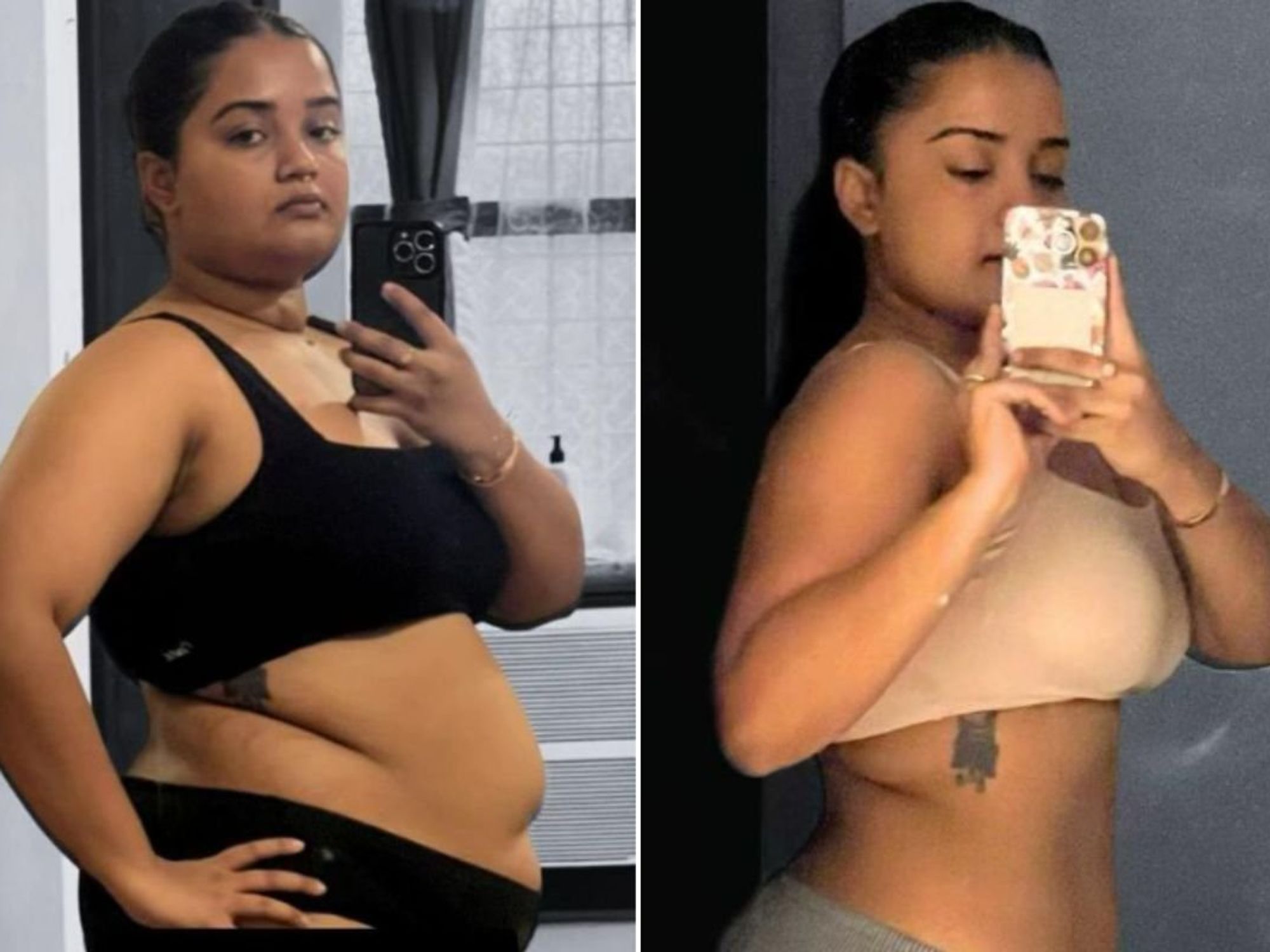 SHARON BEFORE AND AFTER