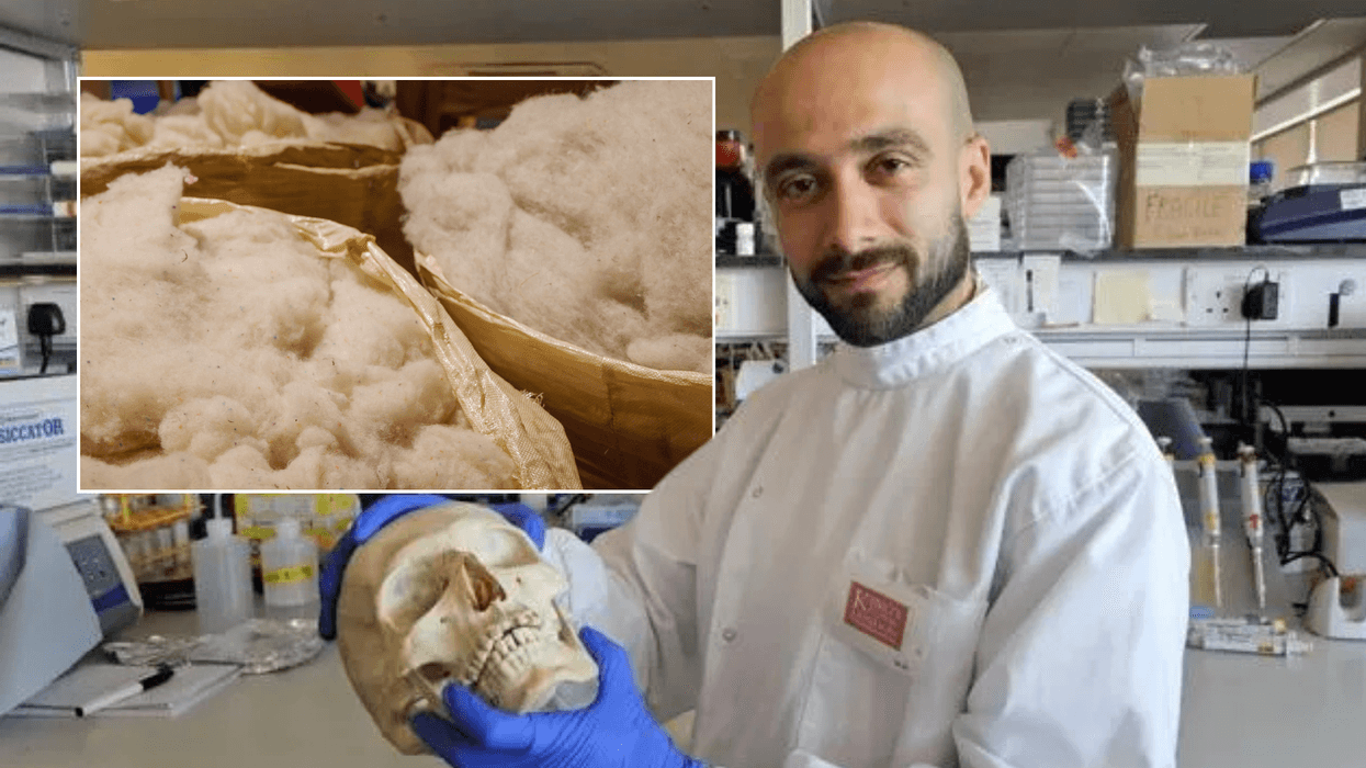 Sheep wool; Dr Sherif Elsharkawy,