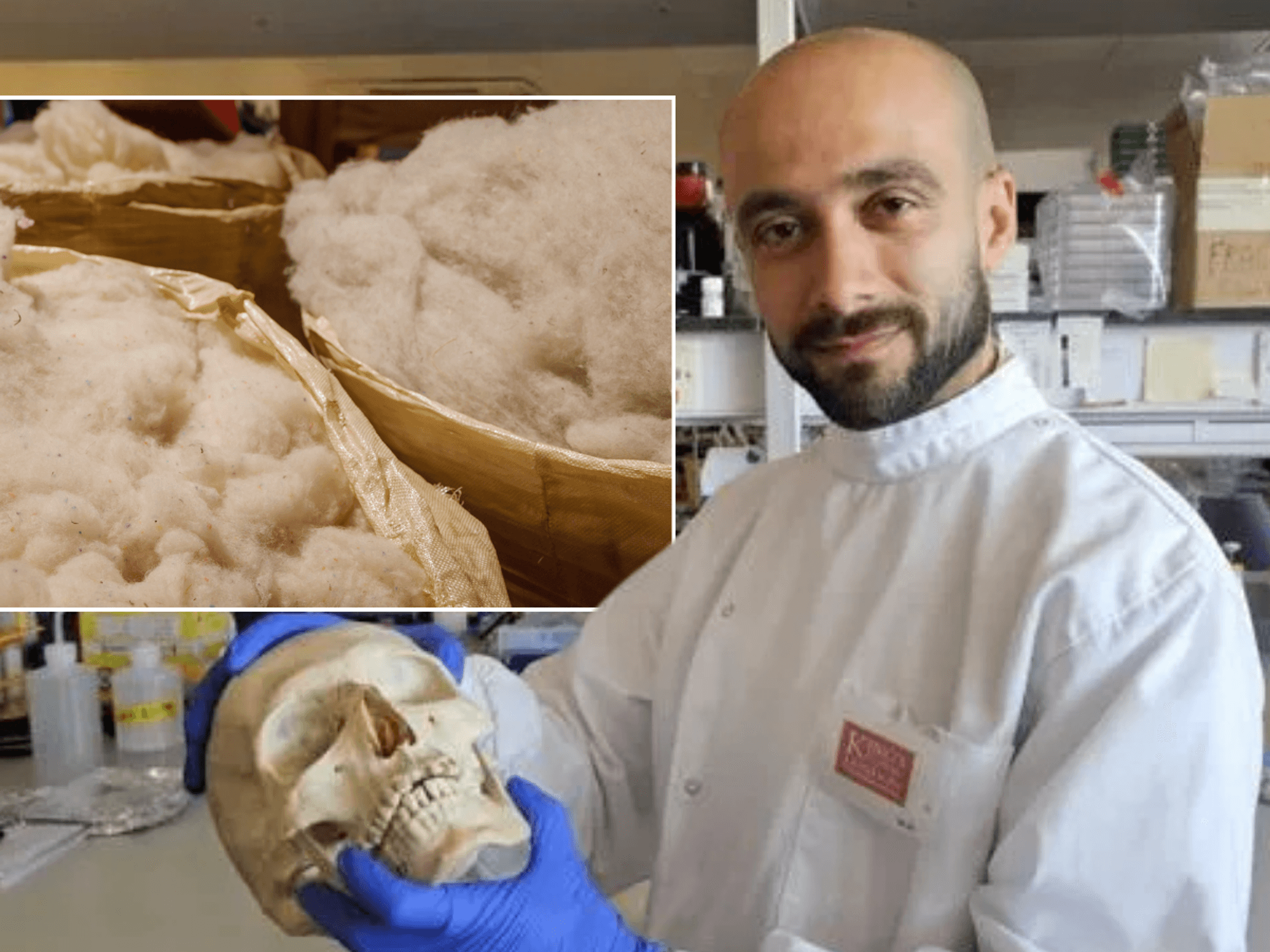 Sheep wool; Dr Sherif Elsharkawy,