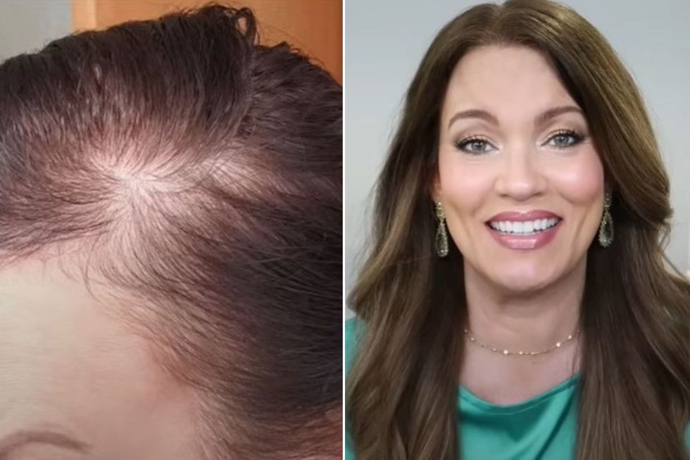 Sheri before and after