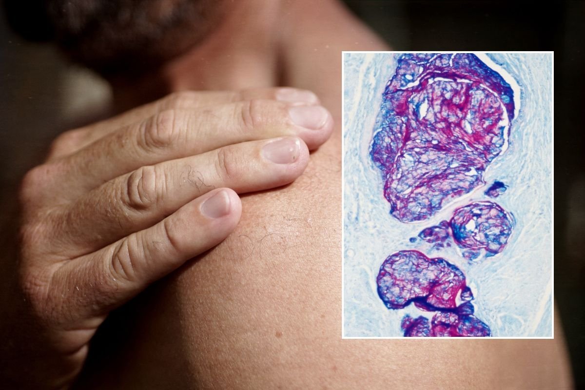 shoulder pain and cancer imaging