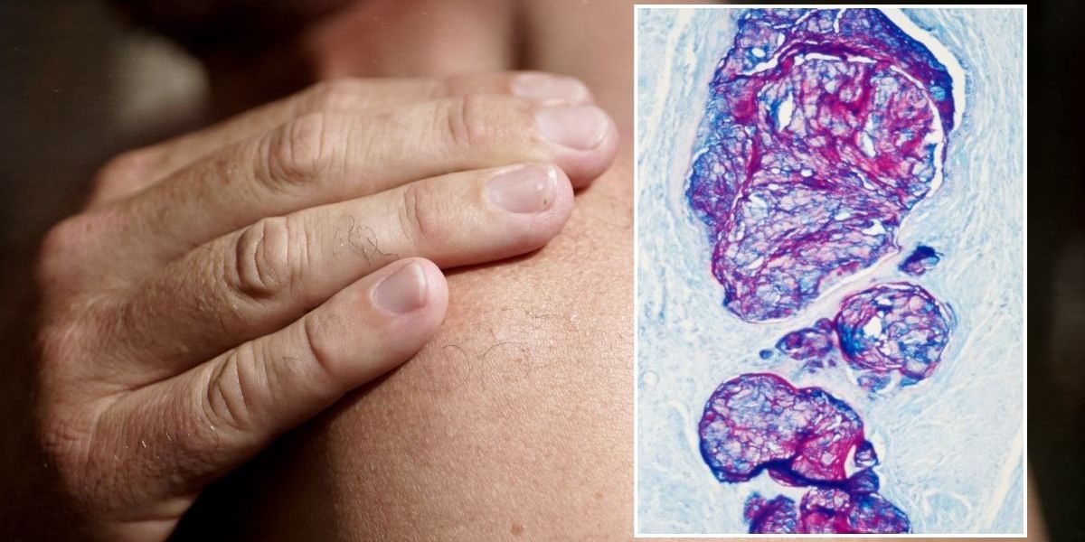 NHS issues ‘be aware’ cancer alert urging Britons to spot key symptoms from head to toe NHS issues ‘be aware’ cancer alert urging Britons to spot key symptoms from head to toe