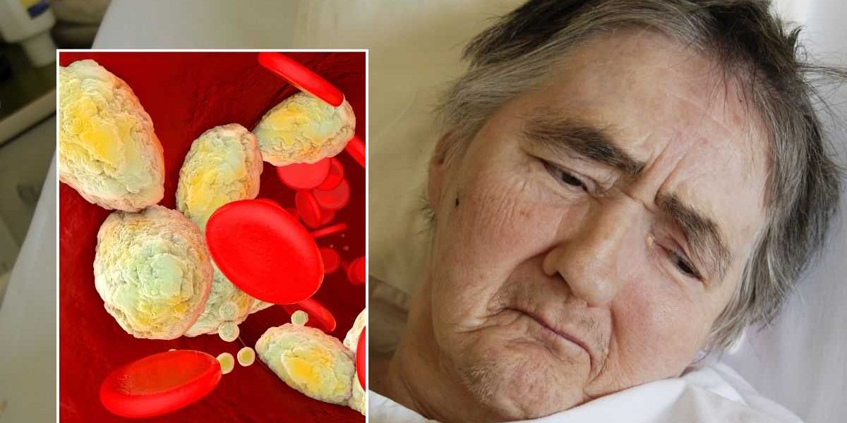 NextImg:Over 99% of patients exhibit at least 1 sign years before suffering a heart attack or stroke, scientists warn