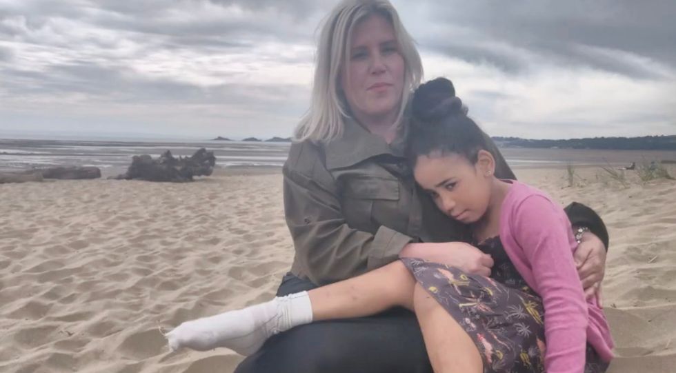 Simi Adenaike could undergo a skin graft following severe burns from hidden beach barbecue