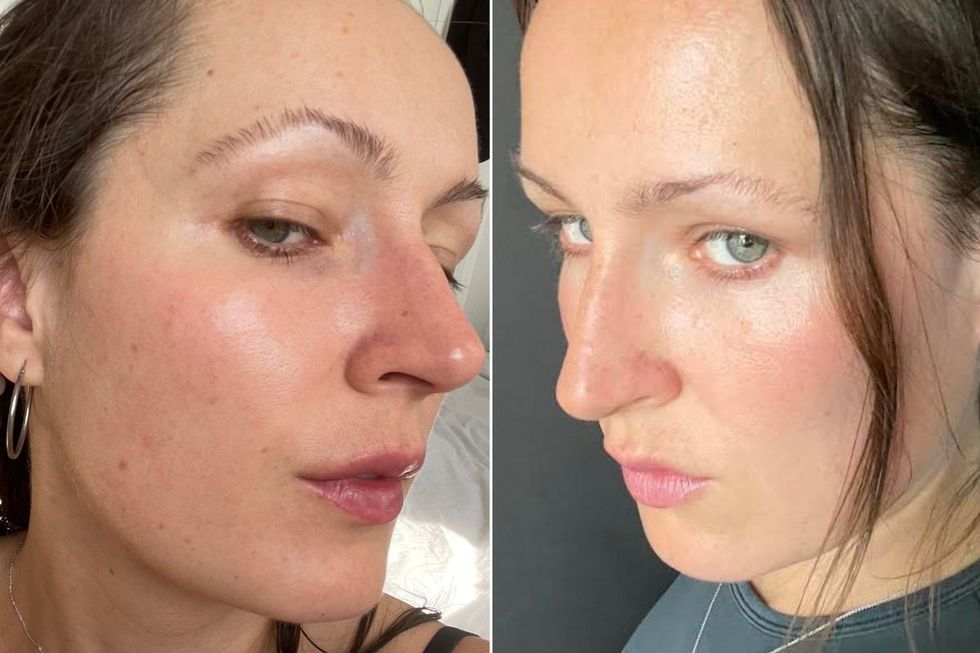 Skin before and after
