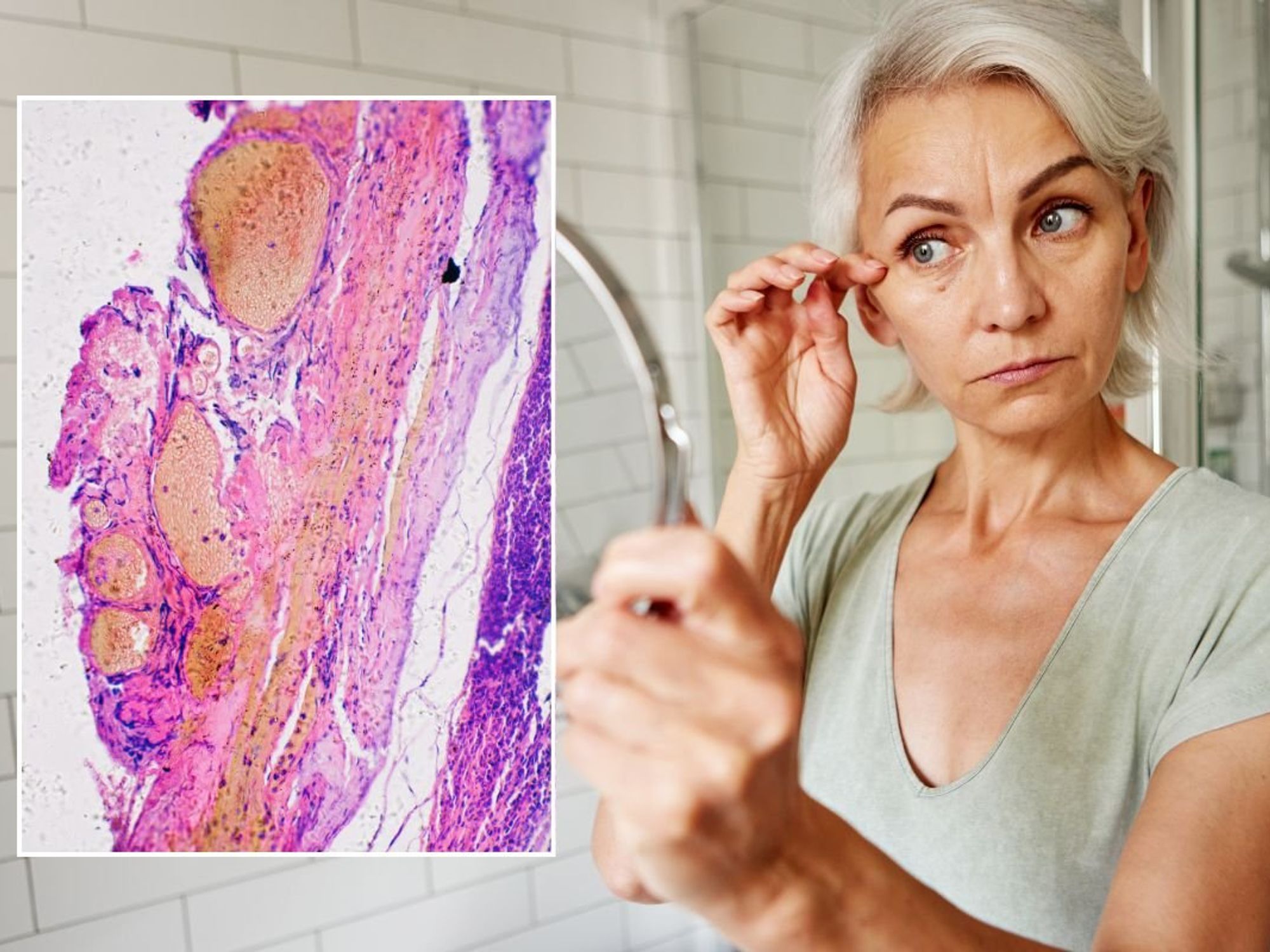 SKIN CANCER AND WOMAN CHECKING MIRROR