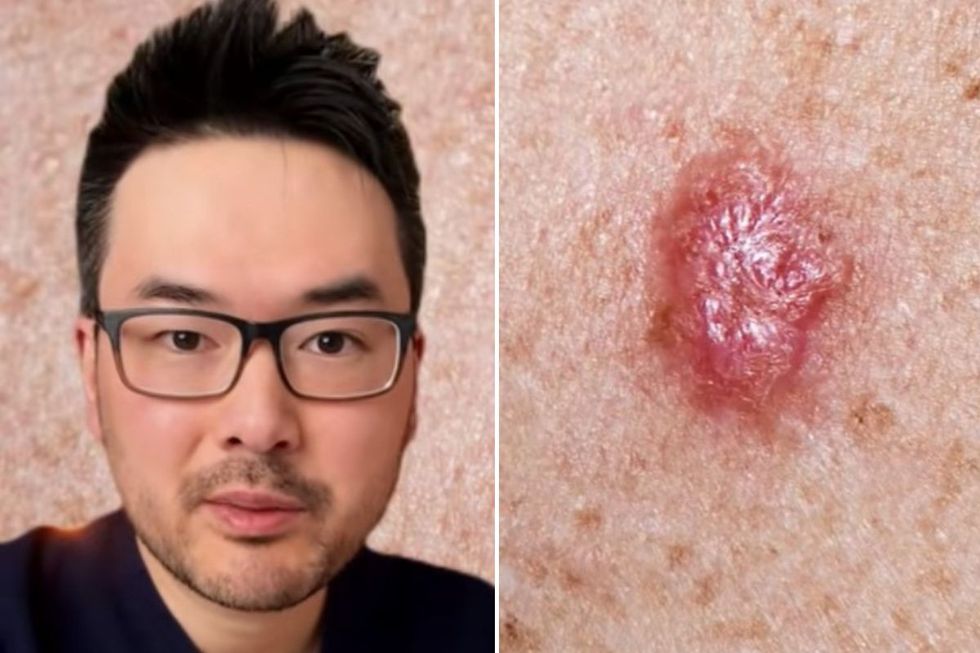The doctor describes the sign of cancer he sees in a “good number” of 30 years

 Aitrend